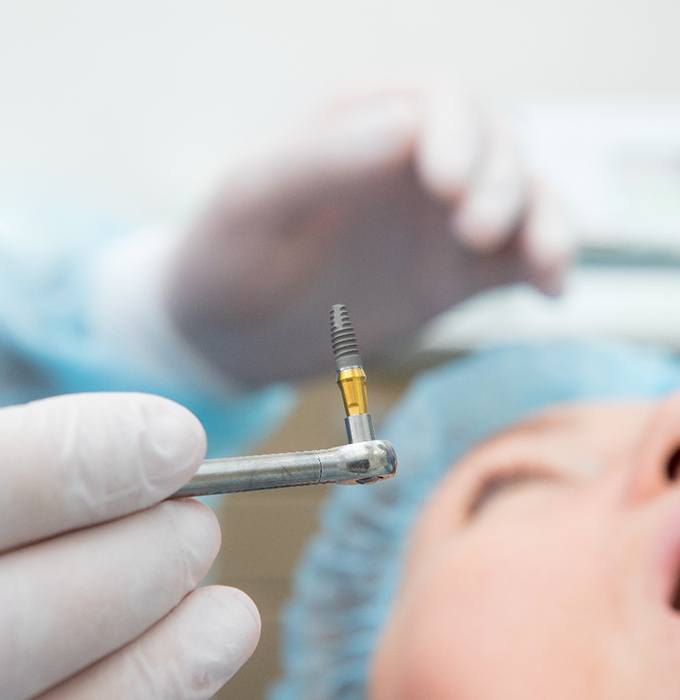 Dentist using dental implants in Flint to replace teeth