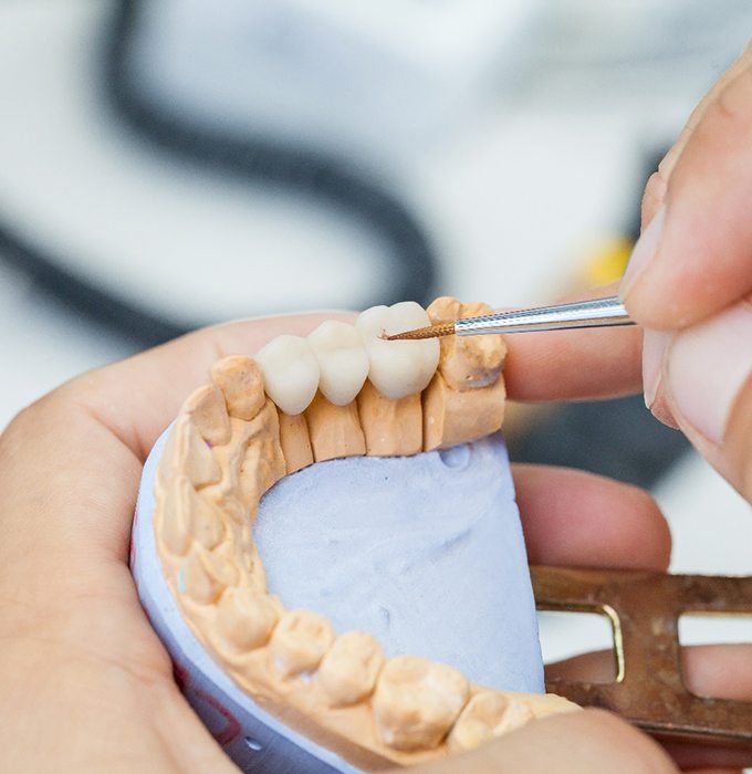 a dental lab technician crafting a bridge