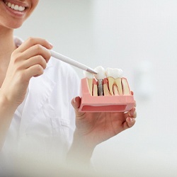 Dentist pointing to model during consultation for dental implants in Flint, MI