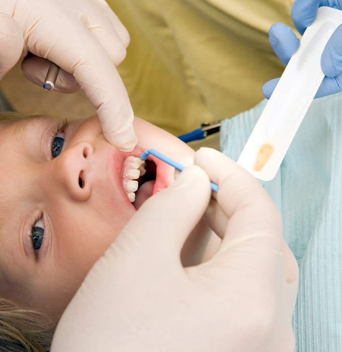 Patient receiving fluoride treatment